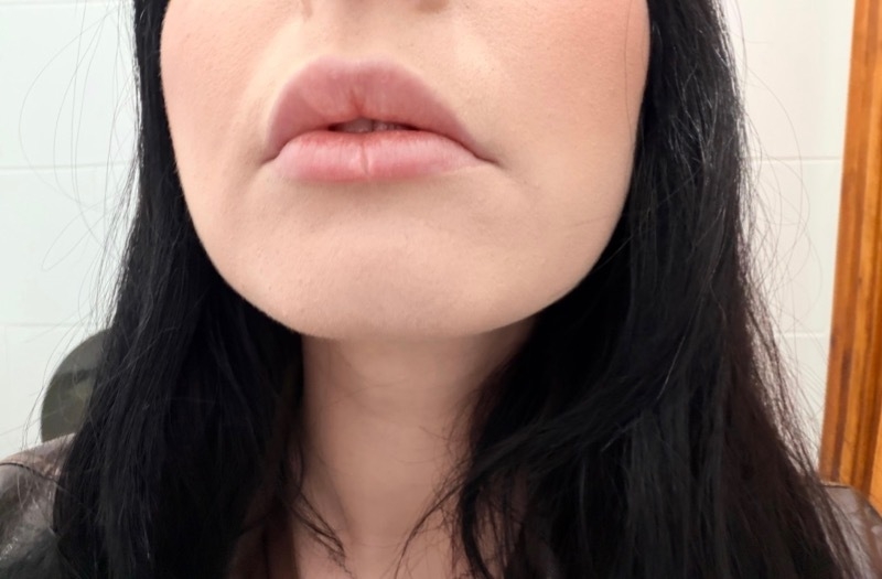 2026 05 20 Harley Lips Before 1